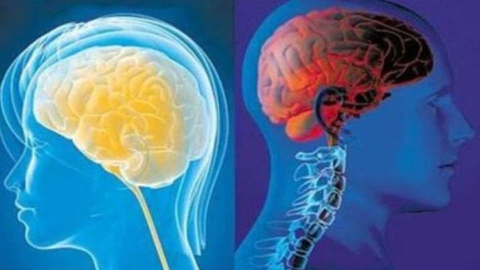 جديد العلم.. رقاقات في أدمغة الناس تعالج أمراضها