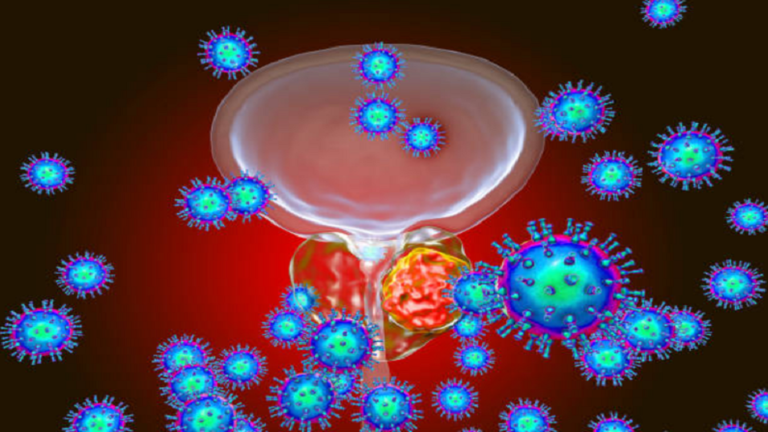 عقار شائع يحد من إصابة الرجال بشكل فتاك من سرطان البروستات