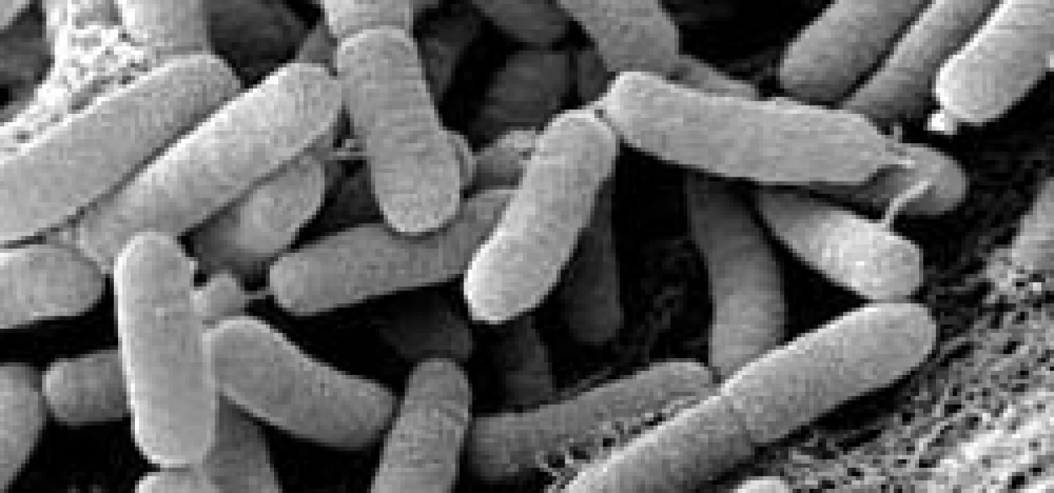 photodune-3834701-laughing-girl-xs